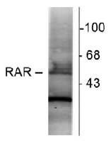 NB200-322 - RAR-alpha / RARA