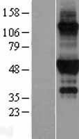 NBL1-15155 - Retinoic Acid Receptor alpha Lysate