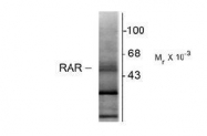 NB200-323 - RAR-beta / RARB