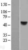 NBL1-15157 - Retinoic Acid Receptor beta Lysate