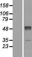 NBL1-15158 - Retinoic Acid Receptor beta Lysate