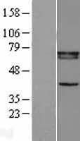 NBL1-15642 - Retinoid X Receptor beta Lysate