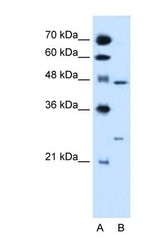 NBP1-52815 - RXR-gamma / RXRG