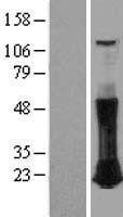 NBL1-15354 - RHOC Lysate
