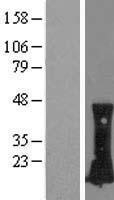 NBL1-15355 - RHOC Lysate