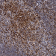 NBP1-88832 - RhoG