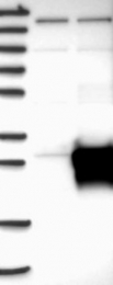 NBP1-89012 - RhoJ