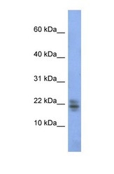 NBP1-69256 - RNASE1