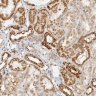 NBP1-89590 - RC3H1 / RNF198 / Roquin