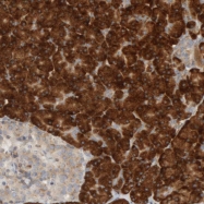 NBP1-80835 - Ribophorin-2 / RPN2