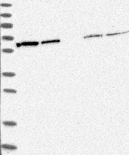 NBP1-80835 - Ribophorin-2 / RPN2