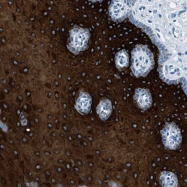NBP1-90092 - Ryanodine receptor 2 / RYR2