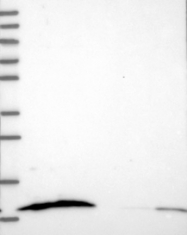 NBP1-92361 - S100A16