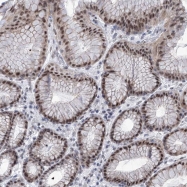 NBP1-89023 - SART1