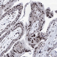 NBP1-89024 - SART1