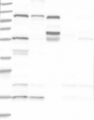 NBP1-89022 - SART1