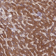 NBP1-89274 - SCD5