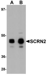 NBP1-77188 - Secernin-2 (SCRN2)
