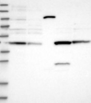 NBP1-85994 - Secernin-2 (SCRN2)