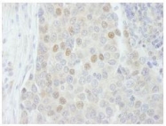 NB100-60426 - RBM27