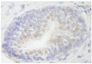 NB100-60426 - RBM27