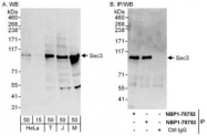 NBP1-78752 - EXOC1 / SEC3