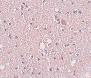 NBP1-77090 - SIPA1L2