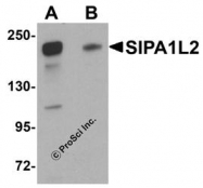 NBP1-77090 - SIPA1L2