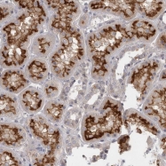 NBP1-82501 - SLC22A11 / OAT4