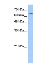 NBP1-62501 - SLC22A11 / OAT4