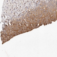NBP1-89049 - SLC25A24 / SCAMC1
