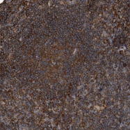 NBP1-80579 - Zinc transporter 2 / SLC30A2
