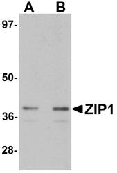NBP1-76498 - Zinc transporter ZIP1 / SLC39A1