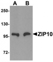 NBP1-76507 - Zinc transporter ZIP10 / SLC39A10