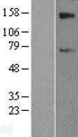 NBL1-16142 - SLC39A12 Lysate