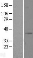 NBL1-16143 - SLC39A13 Lysate