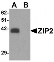 NBP1-76499 - Zinc transporter ZIP2 / SLC39A2