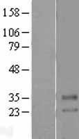 NBL1-16145 - SLC39A2 Lysate