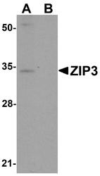 NBP1-76500 - Zinc transporter ZIP3 / SLC39A3
