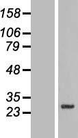 NBL1-16146 - SLC39A3 Lysate