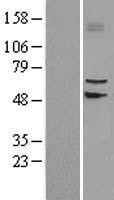 NBL1-16147 - SLC39A4 Lysate