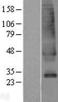 NBL1-16152 - SLC39A9 Lysate