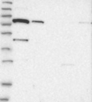 NBP1-88641 - SLC6A12