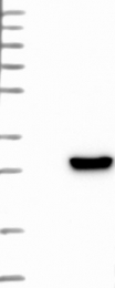 NBP1-87981 - Transgelin (TAGLN)