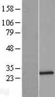 NBL1-16288 - SNRPB2 Lysate