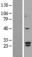 NBL1-16289 - SNRPB2 Lysate