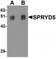 NBP1-77087 - TRIM51 / SPRYD5