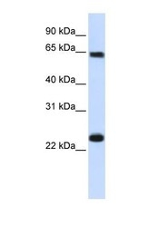 NBP1-54603 - KPNA1 / Importin alpha-1