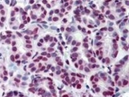 NBP1-77817 - Histone H3.2