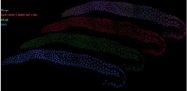 41970002 - UNC84A